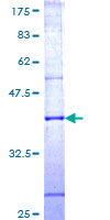 NTM / Neurotrimin Protein - 12.5% SDS-PAGE Stained with Coomassie Blue.