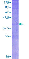 NTN1 / Netrin 1 Protein - 12.5% SDS-PAGE Stained with Coomassie Blue.