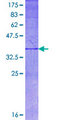 NTN1 / Netrin 1 Protein - 12.5% SDS-PAGE Stained with Coomassie Blue.