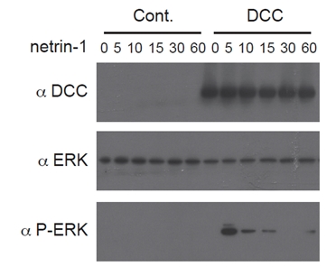 NTN1 / Netrin 1 Protein - Netrin-1 (human):Fc (human) (rec.) triggers a DCC-dependent phosphorylation of ERK1/2. Method: HEK 293 cells (Control) or HEK 293 expressing the netrin-1 receptor DCC were incubated with netrin-1 (human):Fc (human) (rec.) (5 nM) for the indicated time points (shown in minutes). Antibodies against DCC, total ERK1/2 or phospho-ERK1/2 were used and visualized with a chemiluminescence detection system. Picture courtesy of Nicolas Rama, Prof. Patrick Mehlen lab, Centre Leon Berard, Lyon