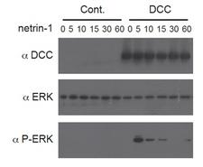 NTN1 / Netrin 1 Protein - Netrin-1 (human):Fc (human) (rec.) triggers a DCC-dependent phosphorylation of ERK1/2. Method: HEK 293 cells (Control) or HEK 293 expressing the netrin-1 receptor DCC were incubated with netrin-1 (human):Fc (human) (rec.) (5 nM) for the indicated time points (shown in minutes). Antibodies against DCC, total ERK1/2 or phospho-ERK1/2 were used and visualized with a chemiluminescence detection system. Picture courtesy of Nicolas Rama, Prof. Patrick Mehlen lab, Centre Leon Berard, Lyon
