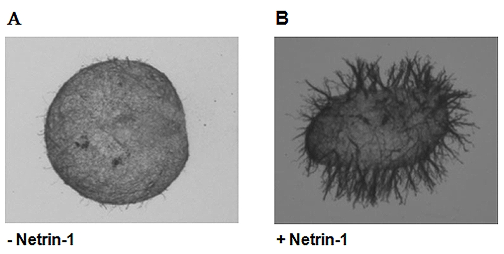 NTN1 / Netrin 1 Protein - Netrin-1 (human):Fc (human) (rec.) induces outgrowth of the commisural axon.Method: Dorsal spinal cords were dissected out from E13 rat embryos and cultured in collagen matrix in the presence or absence of netrin-1 (250ng/ml). Axons were then stained with an anti-beta-tubulin antibody. Picture courtesy of Dr. Veronique Corset, Prof. Patrick Mehlen lab, Centre Leon Berard, Lyon