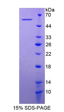 NTN4 / Netrin 4 Protein - Recombinant Netrin 4 By SDS-PAGE