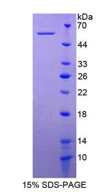 NTN4 / Netrin 4 Protein - Recombinant Netrin 4 By SDS-PAGE