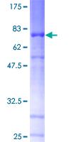 NTNG1 / Netrin G1 Protein - 12.5% SDS-PAGE of human NTNG1 stained with Coomassie Blue