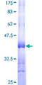 NTNG2 / Netrin G2 Protein - 12.5% SDS-PAGE Stained with Coomassie Blue.