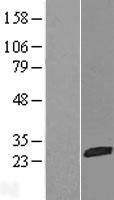 NTPCR / C1orf57 Protein - Western validation with an anti-DDK antibody * L: Control HEK293 lysate R: Over-expression lysate