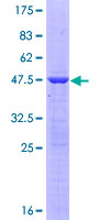 NTPCR / C1orf57 Protein - 12.5% SDS-PAGE of human C1orf57 stained with Coomassie Blue