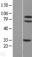 NTRK1 / TrkA Protein - Western validation with an anti-DDK antibody * L: Control HEK293 lysate R: Over-expression lysate