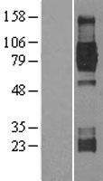 NTRK2 / TRKB Protein - Western validation with an anti-DDK antibody * L: Control HEK293 lysate R: Over-expression lysate