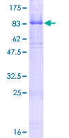 NTRK2 / TRKB Protein - 12.5% SDS-PAGE of human NTRK2 stained with Coomassie Blue