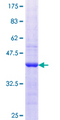 NTRK2 / TRKB Protein - 12.5% SDS-PAGE Stained with Coomassie Blue.