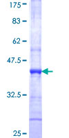 NTRK3 / TRKC Protein - 12.5% SDS-PAGE Stained with Coomassie Blue.