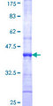 NTRK3 / TRKC Protein - 12.5% SDS-PAGE Stained with Coomassie Blue.