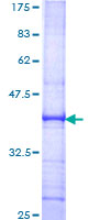 NTS / NT / Neurotensin Protein - 12.5% SDS-PAGE Stained with Coomassie Blue.