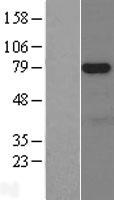 NUAK1 / ARK5 Protein - Western validation with an anti-DDK antibody * L: Control HEK293 lysate R: Over-expression lysate