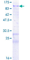 NUAK1 / ARK5 Protein - 12.5% SDS-PAGE of human NUAK1 stained with Coomassie Blue