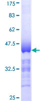 NUAK1 / ARK5 Protein - 12.5% SDS-PAGE Stained with Coomassie Blue.