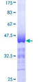 NUAK1 / ARK5 Protein - 12.5% SDS-PAGE Stained with Coomassie Blue.