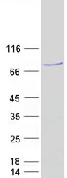 NUB1 Protein - Purified recombinant protein NUB1 was analyzed by SDS-PAGE gel and Coomassie Blue Staining