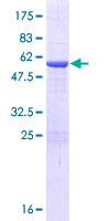 NUBP2 Protein - 12.5% SDS-PAGE of human NUBP2 stained with Coomassie Blue
