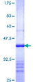 Nucleocapsid Protein Protein - 12.5% SDS-PAGE Stained with Coomassie Blue.