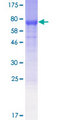 NUDCD1 Protein - 12.5% SDS-PAGE of human NUDCD1 stained with Coomassie Blue