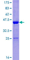 NUDCD2 Protein - 12.5% SDS-PAGE of human NUDCD2 stained with Coomassie Blue