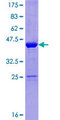 NUDCD2 Protein - 12.5% SDS-PAGE of human NUDCD2 stained with Coomassie Blue