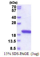 NUDCD2 Protein