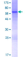 NUDEL / NDEL1 Protein - 12.5% SDS-PAGE of human NDEL1 stained with Coomassie Blue