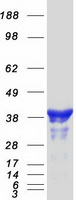 NUDEL / NDEL1 Protein - Purified recombinant protein NDEL1 was analyzed by SDS-PAGE gel and Coomassie Blue Staining