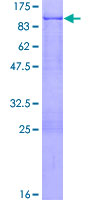 NUDR / DEAF1 Protein - 12.5% SDS-PAGE of human DEAF1 stained with Coomassie Blue