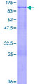 NUDR / DEAF1 Protein - 12.5% SDS-PAGE of human DEAF1 stained with Coomassie Blue