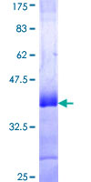 NUDR / DEAF1 Protein - 12.5% SDS-PAGE Stained with Coomassie Blue.