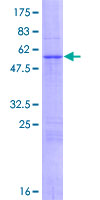 NUDT13 Protein - 12.5% SDS-PAGE of human NUDT13 stained with Coomassie Blue