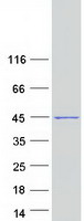 NUDT13 Protein - Purified recombinant protein NUDT13 was analyzed by SDS-PAGE gel and Coomassie Blue Staining