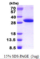 NUDT14 Protein