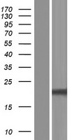 NUDT16 Protein - Western validation with an anti-DDK antibody * L: Control HEK293 lysate R: Over-expression lysate