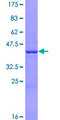 NUDT16 Protein - 12.5% SDS-PAGE of human NUDT16 stained with Coomassie Blue