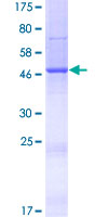 NUDT16L1 Protein - 12.5% SDS-PAGE of human NUDT16L1 stained with Coomassie Blue