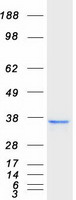 NUDT18 Protein - Purified recombinant protein NUDT18 was analyzed by SDS-PAGE gel and Coomassie Blue Staining