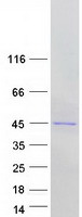 NUDT19 Protein - Purified recombinant protein NUDT19 was analyzed by SDS-PAGE gel and Coomassie Blue Staining