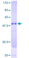 NUDT21 Protein - 12.5% SDS-PAGE of human CPSF5 stained with Coomassie Blue