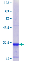 NUDT21 Protein - 12.5% SDS-PAGE Stained with Coomassie Blue.