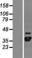 NUDT22 Protein - Western validation with an anti-DDK antibody * L: Control HEK293 lysate R: Over-expression lysate