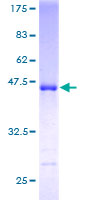 NUDT3 Protein - 12.5% SDS-PAGE of human NUDT3 stained with Coomassie Blue