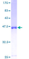 NUDT4 Protein - 12.5% SDS-PAGE of human NUDT4 stained with Coomassie Blue