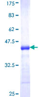 NUDT5 Protein - 12.5% SDS-PAGE Stained with Coomassie Blue.