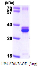 NUDT5 Protein